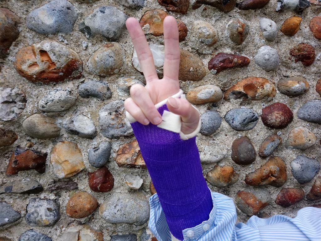cast